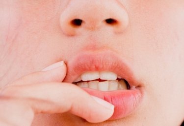 Pflegetipps für spröde Lippen