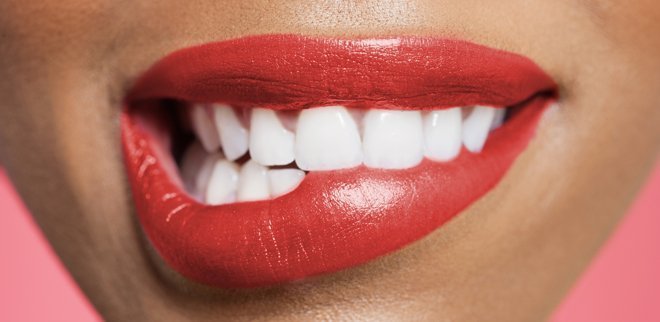 Bleaching: Das musst du übers Zähne bleichen wissen