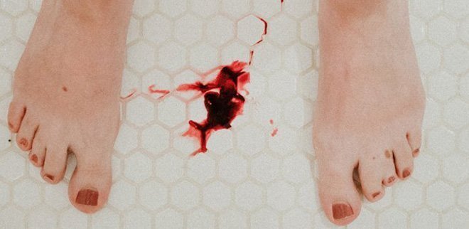 Frau in Dusche verliert Blut