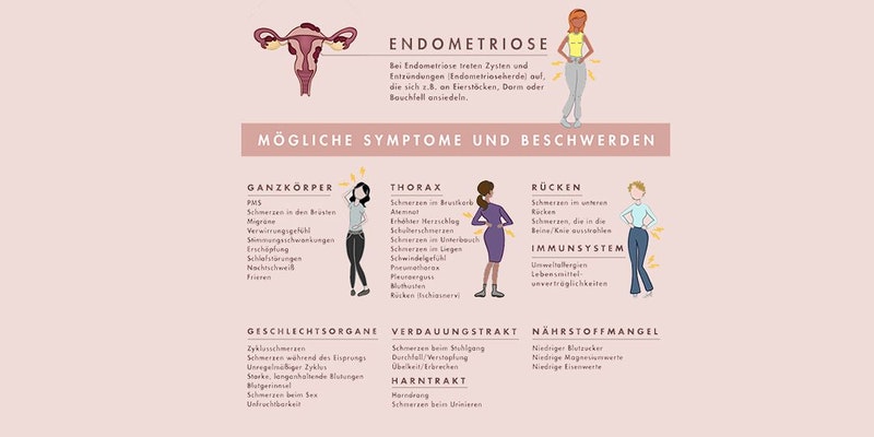 Diese Grafik zeigt die Symptome von Endometriose.